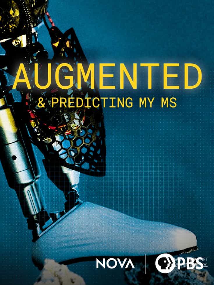 我的多发性硬化症增强与预测 Augmented & Predicting My MS插图 我的多发性硬化症增强与预测 Augmented & Predicting My MS插图