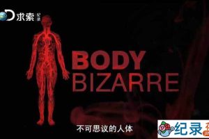 罕见病医治纪录片《人体不思议 Body Bizarre》第1季国语 720P高清纪录片资源百度云盘下载