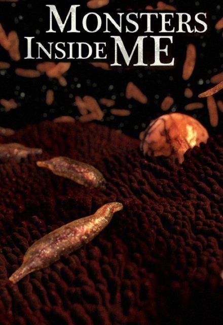 体内的怪物 第一季 Monsters Inside Me Season 1插图1