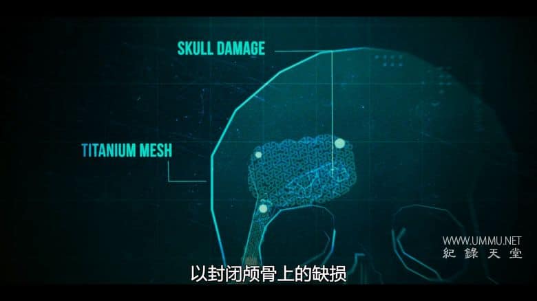 命悬一线：伦敦重症急救实录 Critical: Between Life and Death插图2