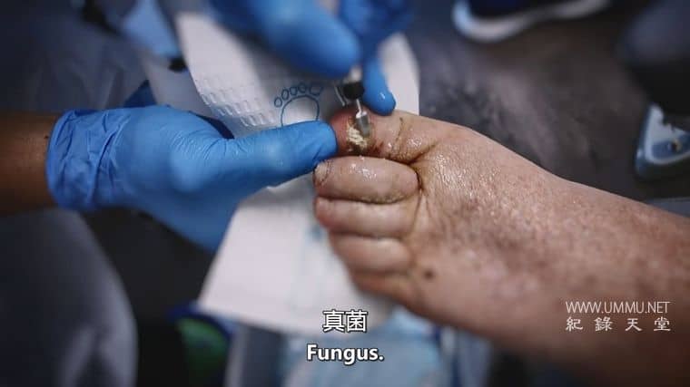 脚趾兄弟 The Toe Bro插图3