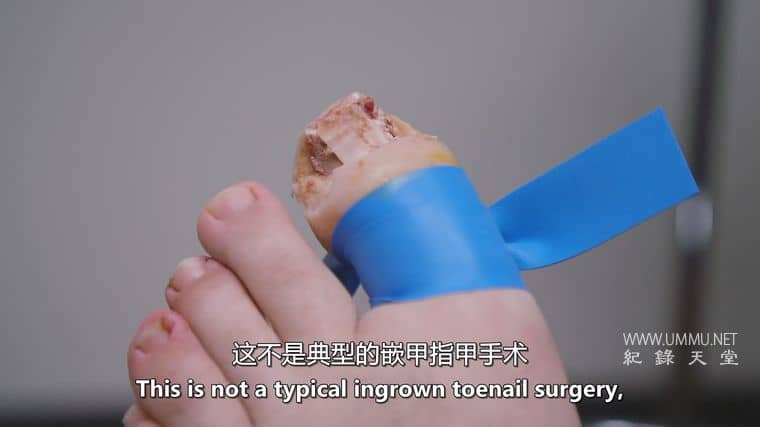 脚趾兄弟 The Toe Bro插图5