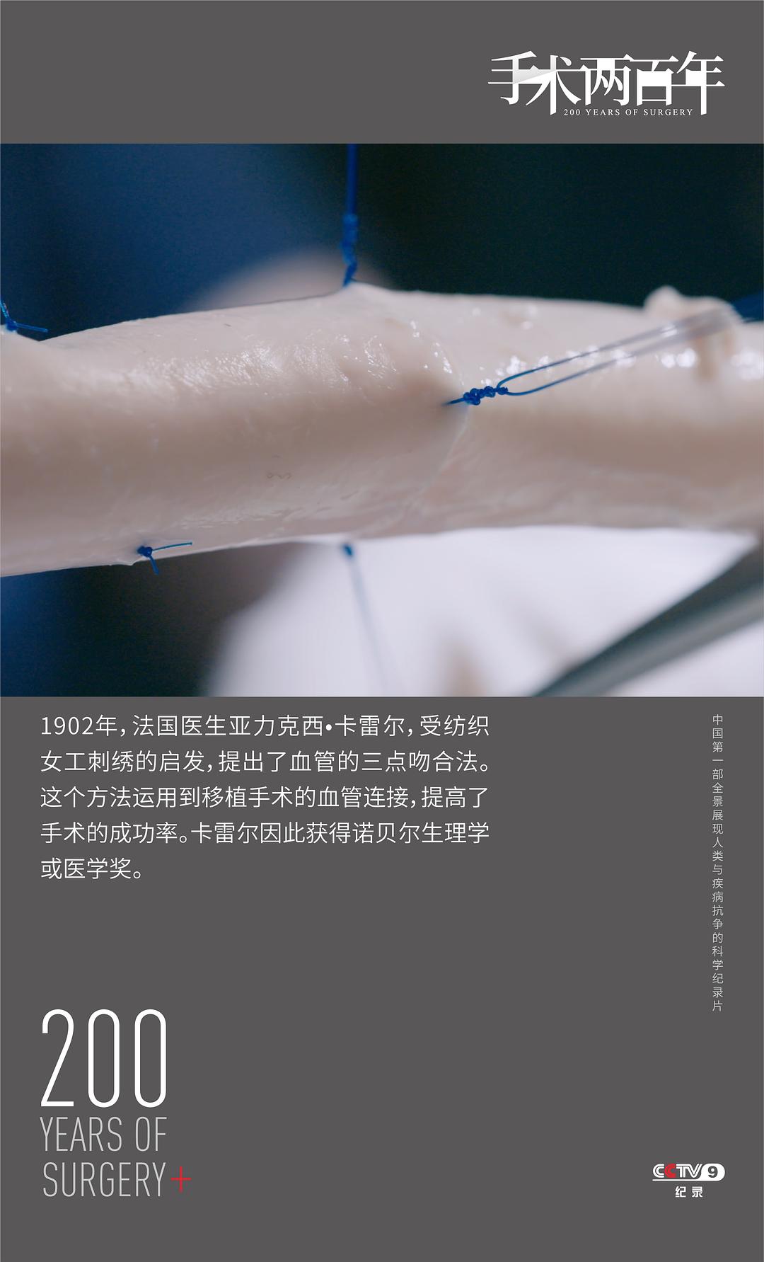 手术两百年插图7