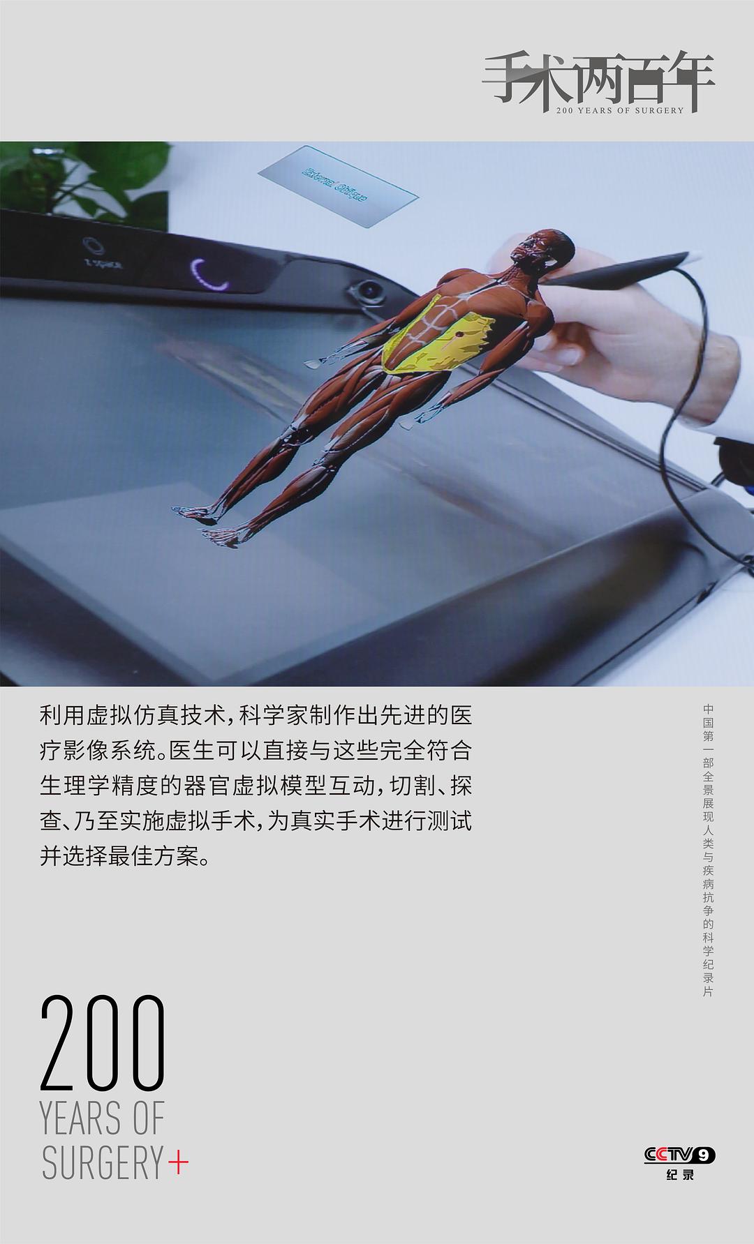 手术两百年插图14