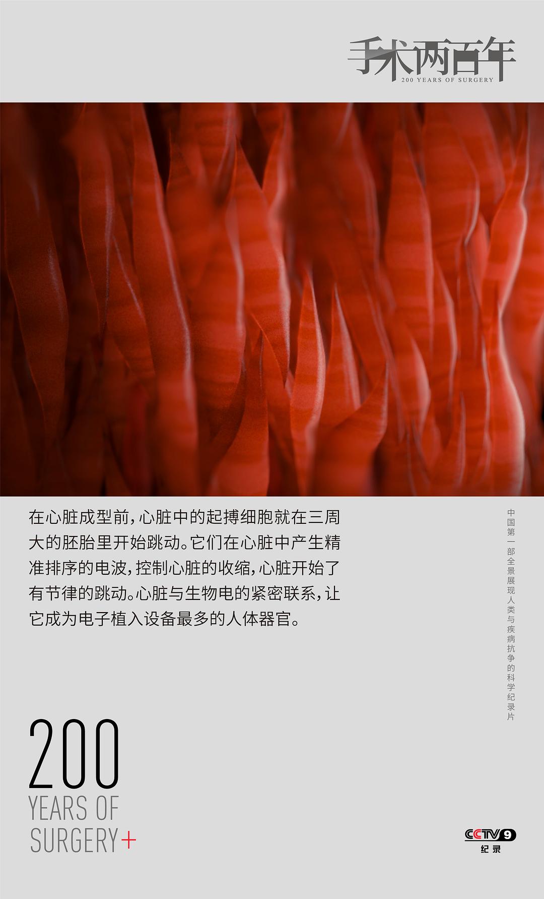 手术两百年插图15