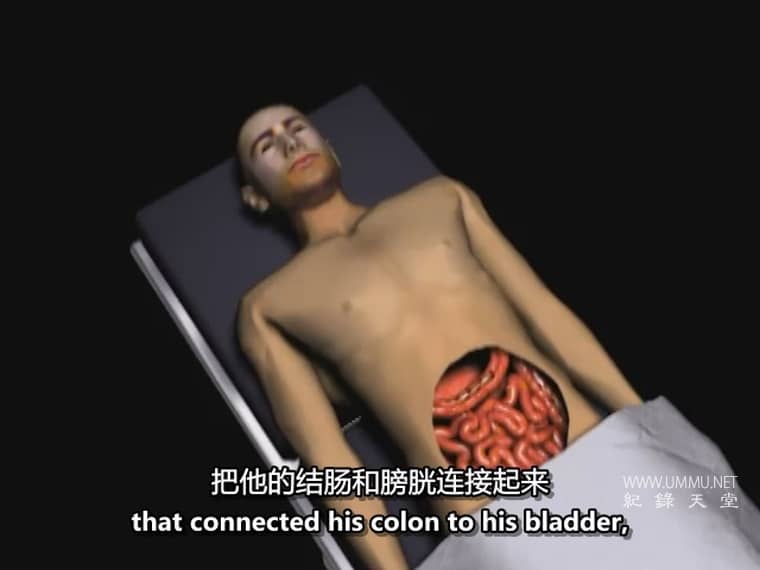 惊人的医学故事 Amazing Medical Stories插图4