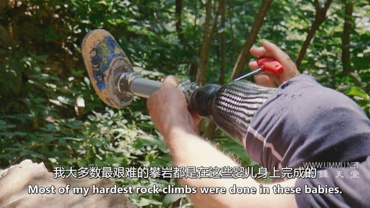 我的多发性硬化症增强与预测 Augmented & Predicting My MS插图2