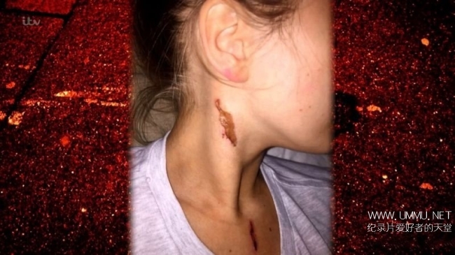 英国泼酸袭击 Acid Attacks How Scared Should We Be插图3