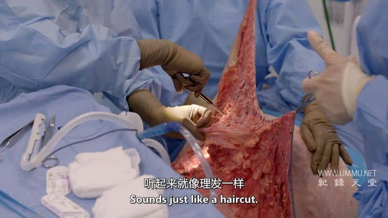 清醒手术 Awake Surgery插图7